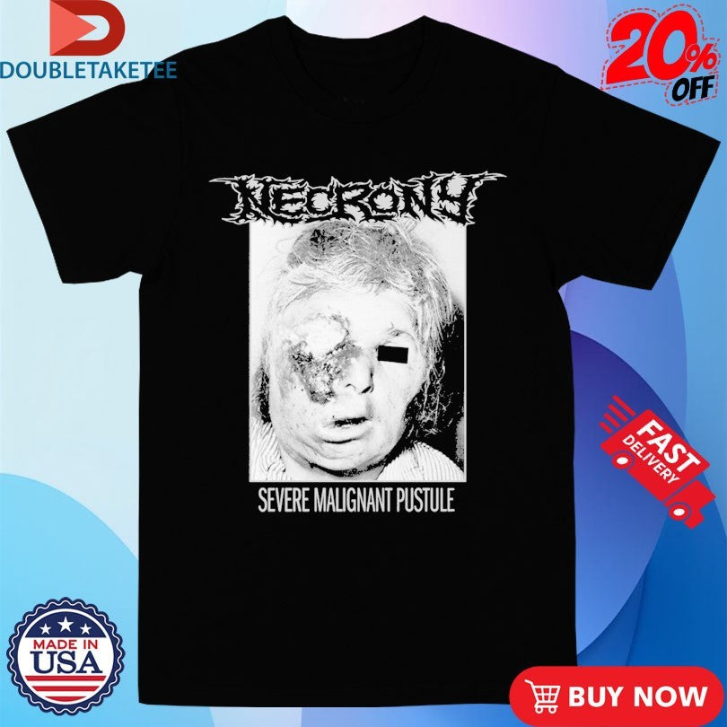 Official Necrony Severe Malignant Pustule Shirts