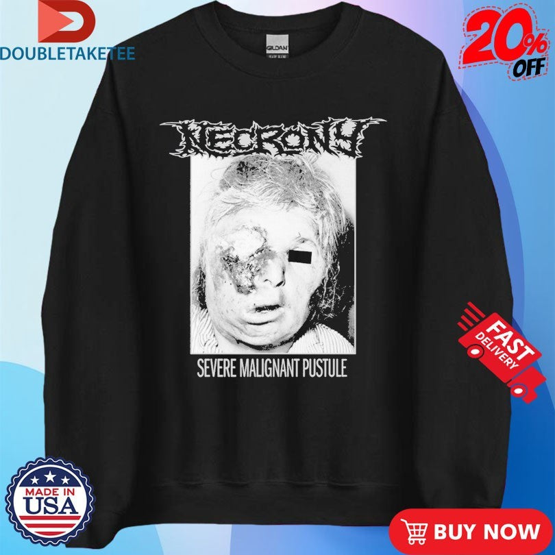 Official Necrony Severe Malignant Pustule Shirts