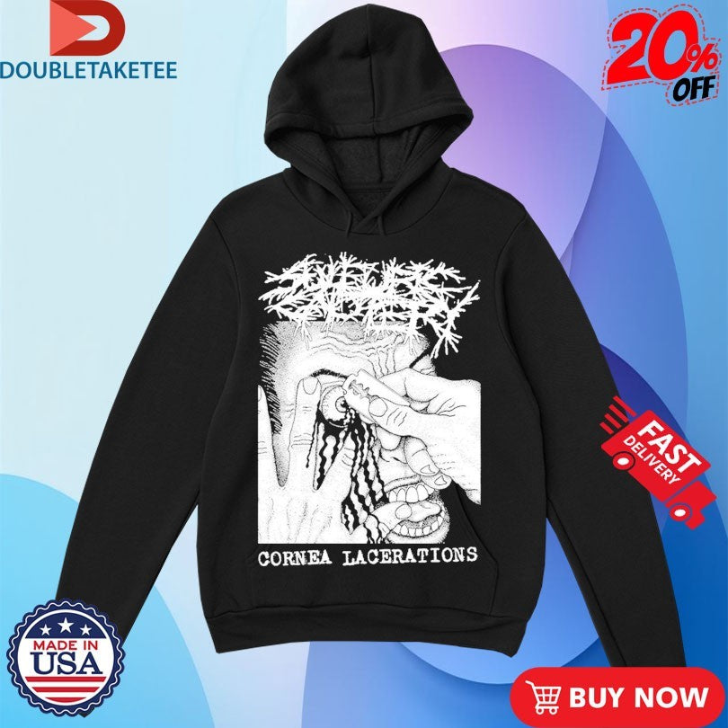 Official Sulfuric Cautery Cornea Lacerations Shirts