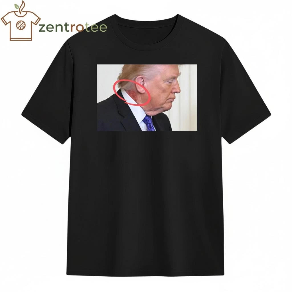 Original Large red mark on the neck of US President Donald Trump tee